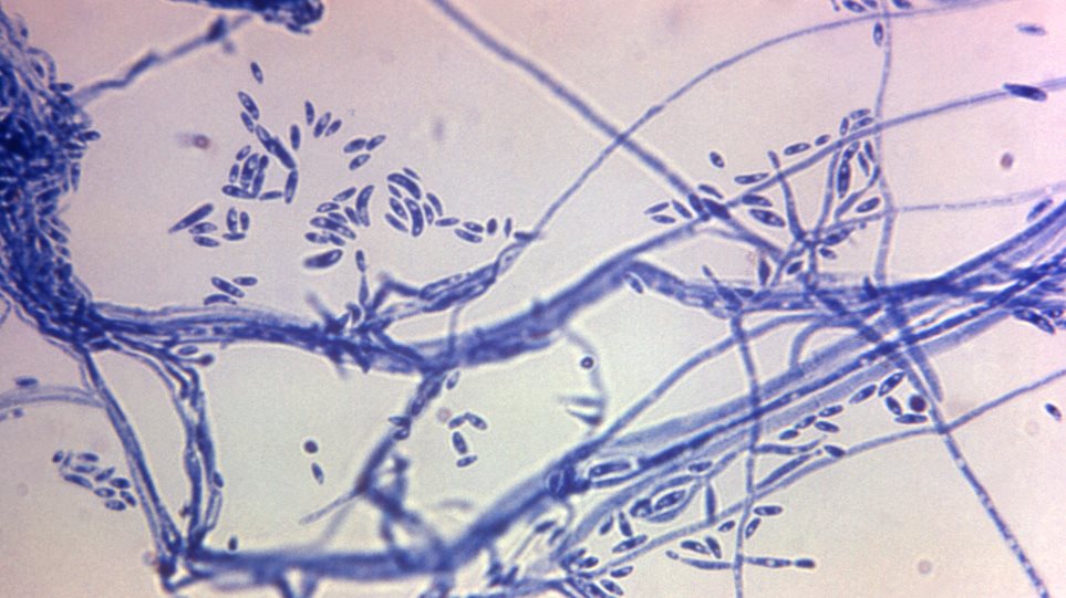 minigitida__Dr__Lucille_K__Georg_CDC_via_AP