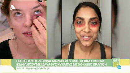 Πως να εξαφανίσουμε τους μαύρους κύκλους με κόκκινο κραγιόν