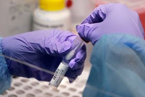 Σχεδόν 100.000 κρούσματα χολέρας σε έναν χρόνο στο Σουδάν