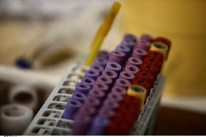 Εθελοντική αιμοδοσία στο ΑΠΘ