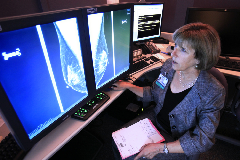 Ο καρκίνος του μαστού σε άνοδο παγκοσμίως-Ανάγκη για αποτελεσματικές παρεμβάσεις