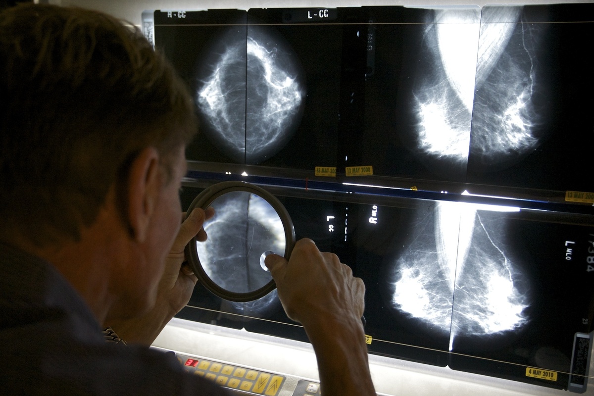 Ανομοιόμορφες αλλαγές υφίστανται τα όργανα μετά την εμμηνόπαυση