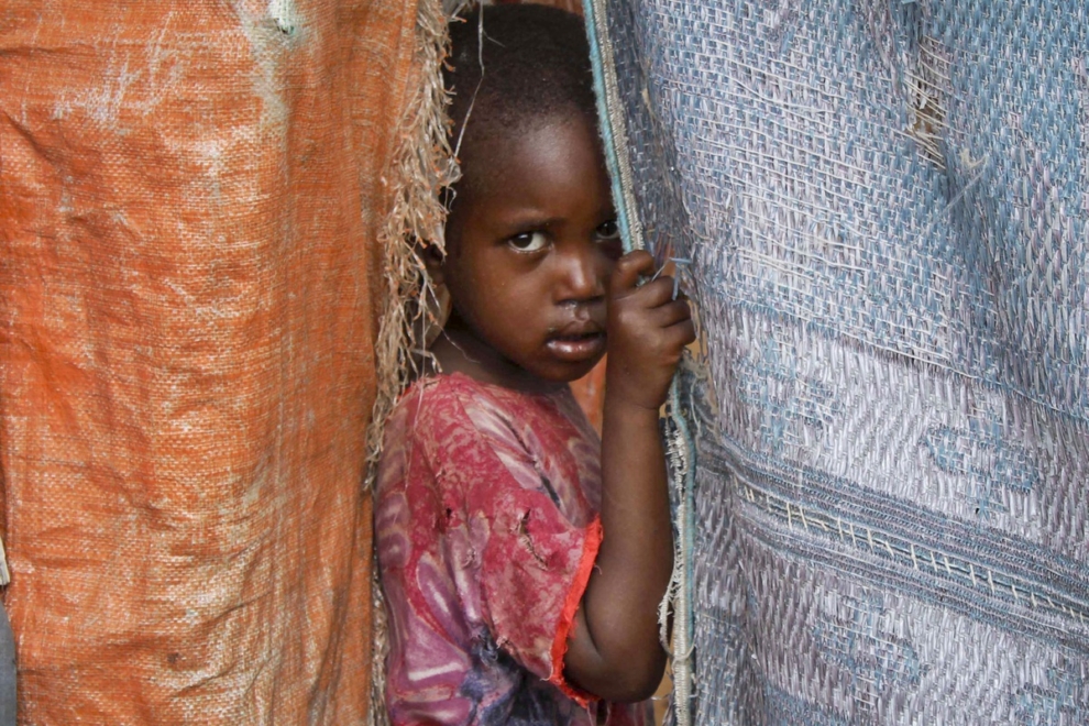 Ο πόλεμος στο Ιράν αποτελεί ακόμη ένα πλήγμα για τα υποσιτισμένα παιδιά στη Σομαλία