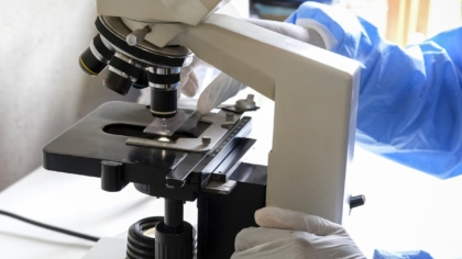 Βρετανία: Το HPV μηδένισε τους θανάτους από καρκίνο τραχήλου