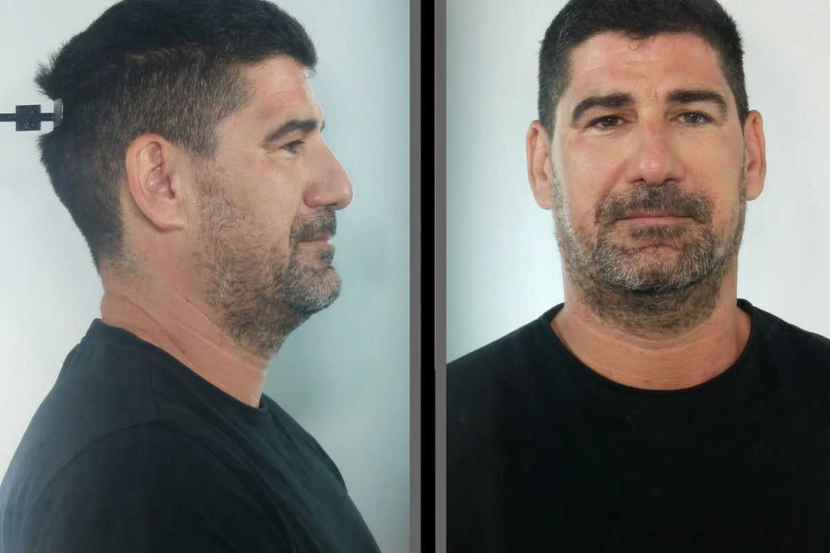 Διώξη για βιασμό σε καθηγητή απο το Αργοστόλι